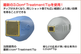 最新の3.0cm² Treatment Tipを使用！